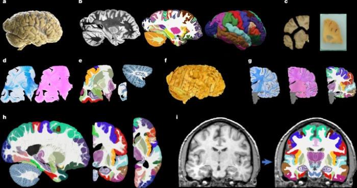 Human brain map research