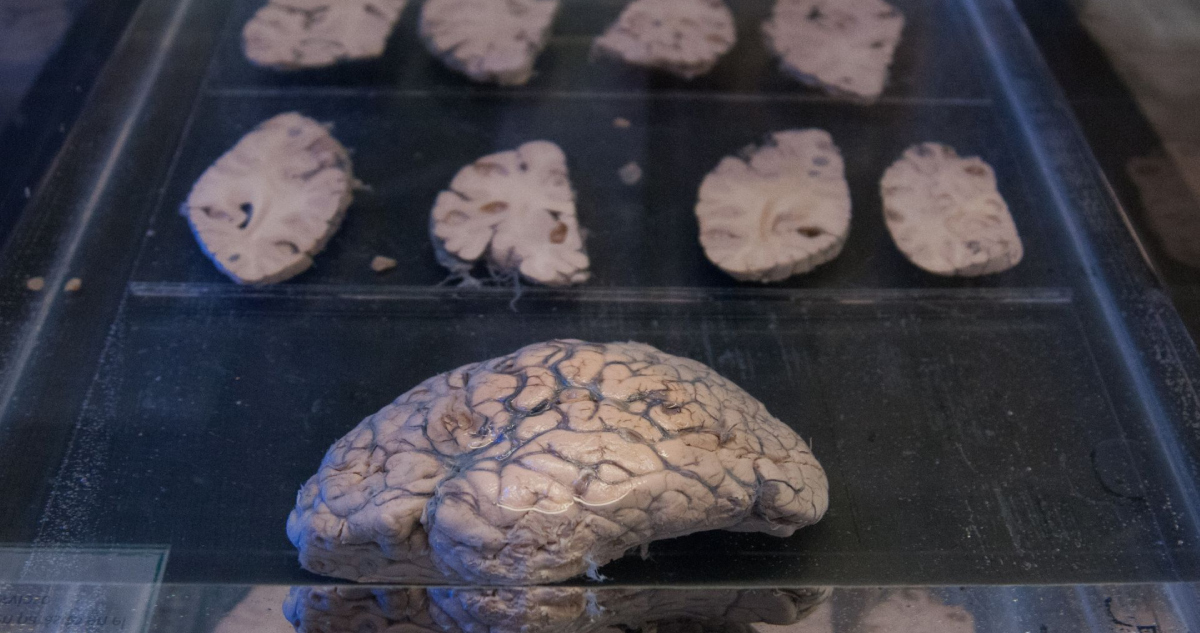 Mapa del Cerebro humano.