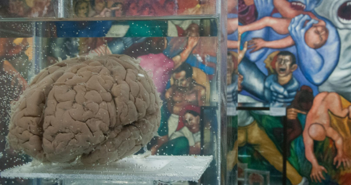 Map of the human brain.