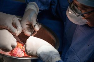 La donación de órganos salva miles de vidas al año en México.