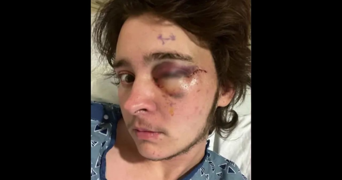 Manifestante pierde un ojo durante protesta contra ICE.