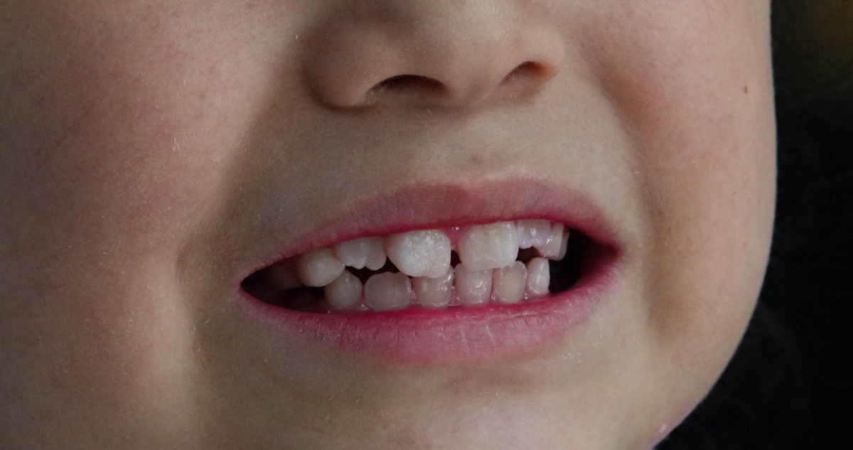 Una odontóloga explicó las diferencias entre una pasta de dientes cara y una barata.