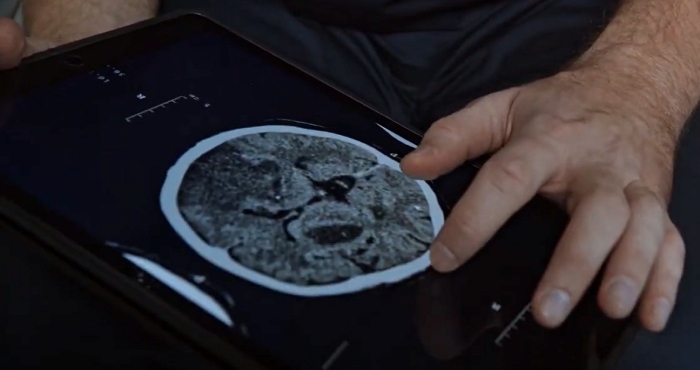 ¿Cómo reconocer una crisis epiléptica y qué hacer ante ella?